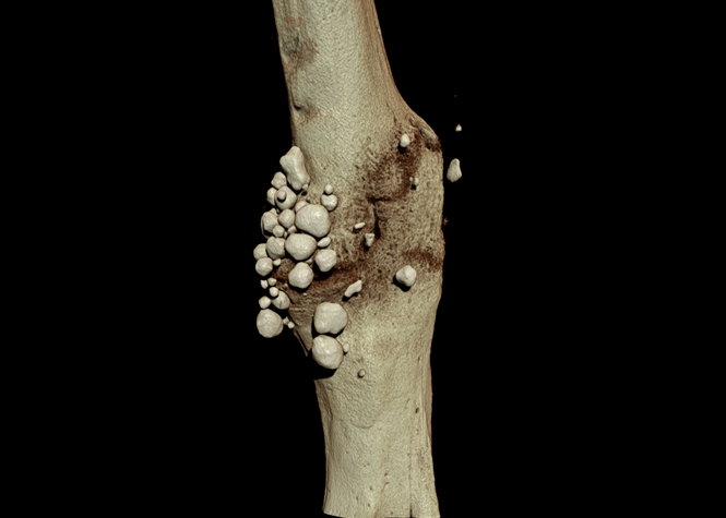 COMPUTERIZED MICROTOMOGRAPHY