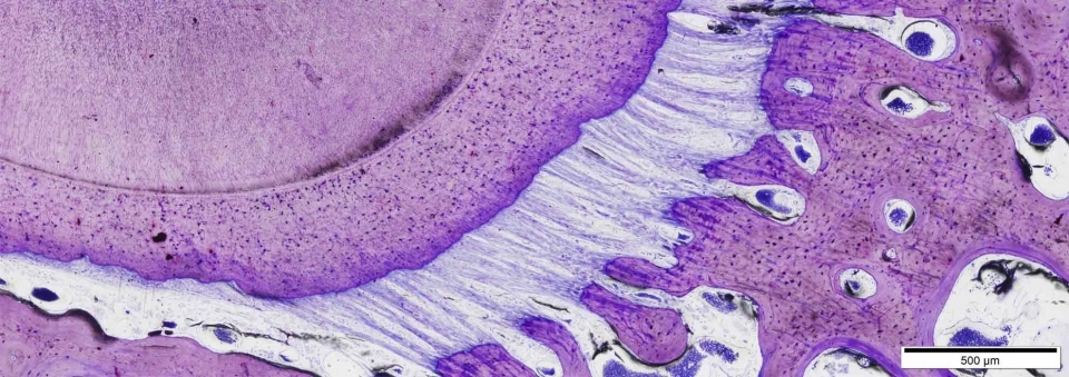 IMPROVING BONE KNOWLEDGE